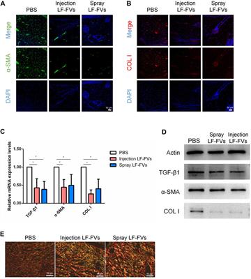 Lipoaspirate fluid derived factors and extracellular vesicles accelerate wound healing in a rat burn model